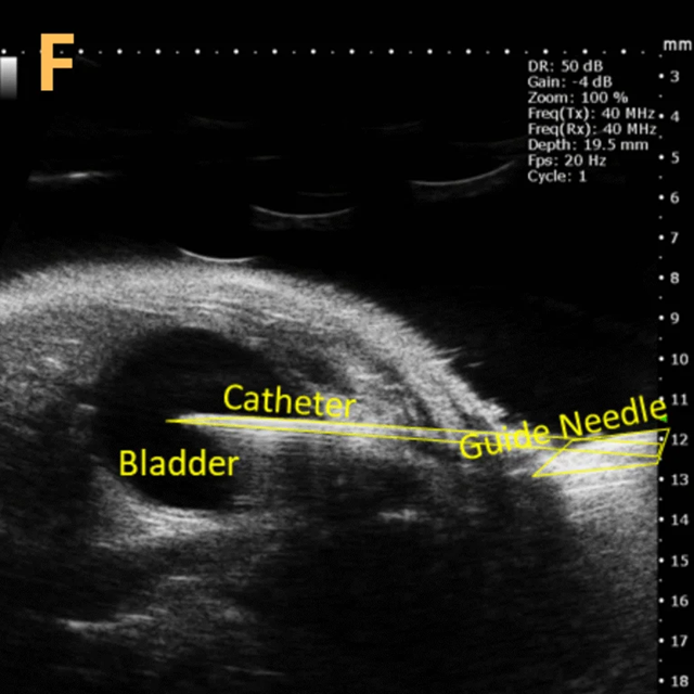 High-frequency ultrasound system for preclinical imaging
