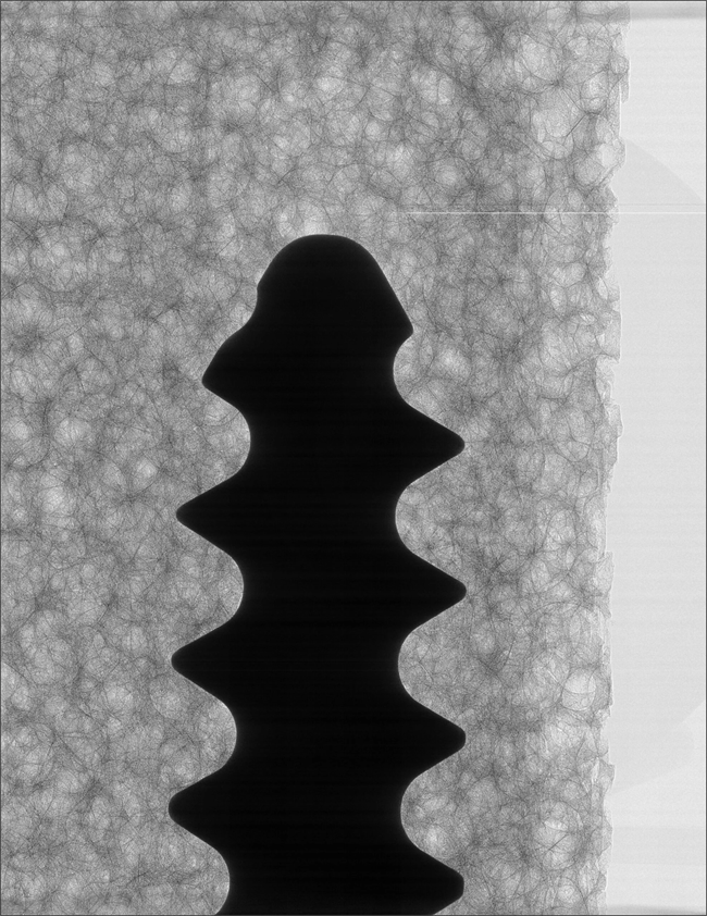 InCiTe 3D X-ray microscope bone imaging scan