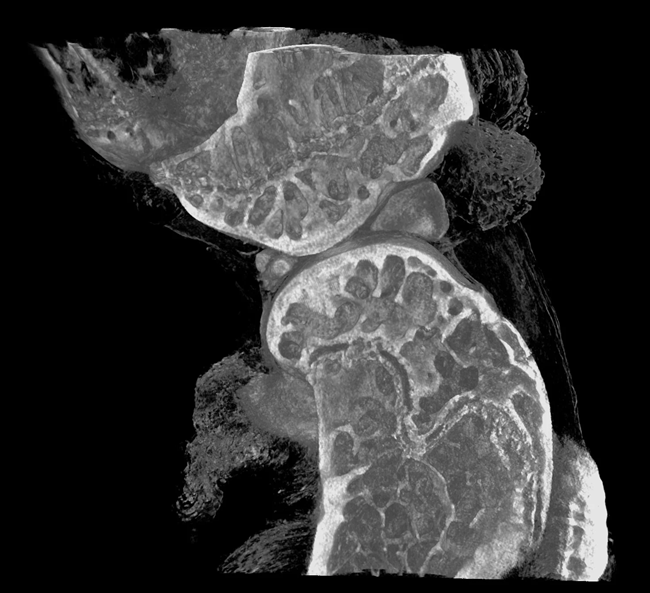 Cartilage and bone imaging analysis with Incite 3X product