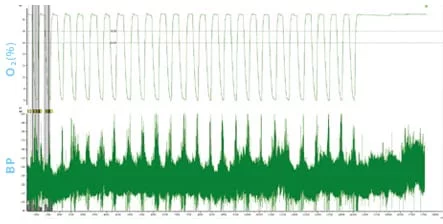 Blood pressure spikes correlate directly with exposure to chronic intermittent hypoxia.