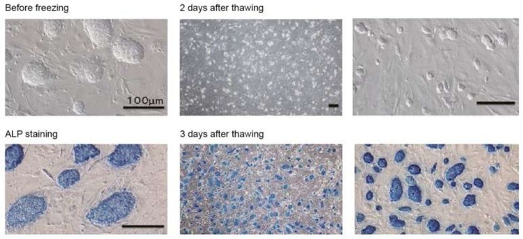 Cell viability and ALP staining of pluripotent stem cells. Upper row: A great number of cells are detected two days after thawing. The cells show no morphological change after thawing. Lower row: Bambanker<sup>™</sup> does not cause cell differentiation as all stem cells frozen down are still producing high levels of alkaline phosphatase, a reporter for pluripotent stem cells