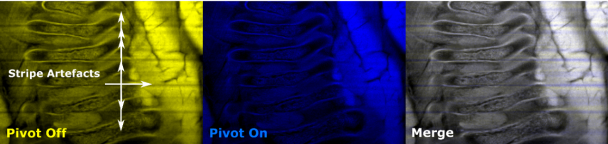 Dual-destriping: Impressive elimination of striping artifacts