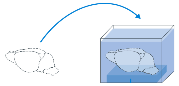 LCS SPIM for high-throughput cleared sample imaging