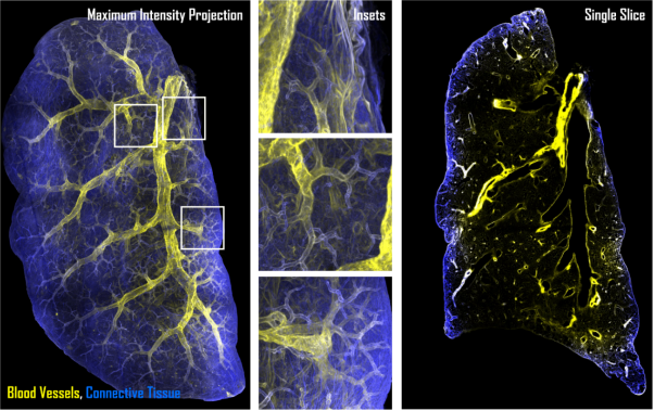 Intricate branching patterns of mouse lungs and blood vessels