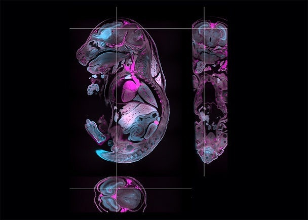 Cleared mouse embryo labeled with methylene blue (cyan) and showing autofluorescence (magenta). Image composed of 12 tiles and 920 planes, all processed and stitched with LuxBundle