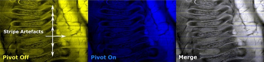 Left: Image collected without the destriping module showing striping artifacts. Center: Image collected with the destriping module showing successful removal of striping artifacts. Right: Merged image of both the left and right image.