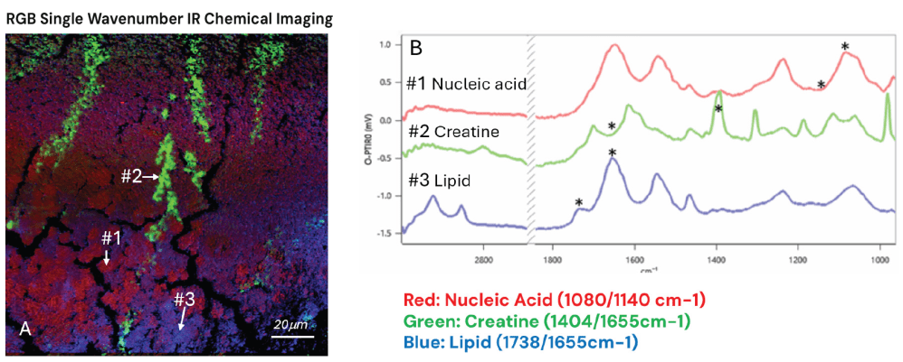 A: Automated multiple (5) single-wavenumber IR chemical imaging RGB overlay: green (creatine) 1404/1655 cm-1, red (nucleic acid) 1080/1140 cm-1, and blue (lipid) 1738/1655 cm-1. B: Representative spectra from the highlighted locations, highlighting biochemistry from areas of chemical contrast as shown in A. IR image (A) wavenumber positions are marked by asterisks. Spectra are collected from a spot size of ∼500 nm.   Collection conditions: 150×150 µm measurement FOV, 250 nm pixel step size (360,000 pixels), 17 seconds per image, counter-prop mode with 50x, 0.8 NA glass objective, dual-range IR QCL, 532 nm probe.