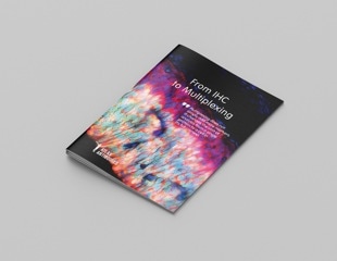From IHC to multiplexing: A practical guide for modern tissue analysis