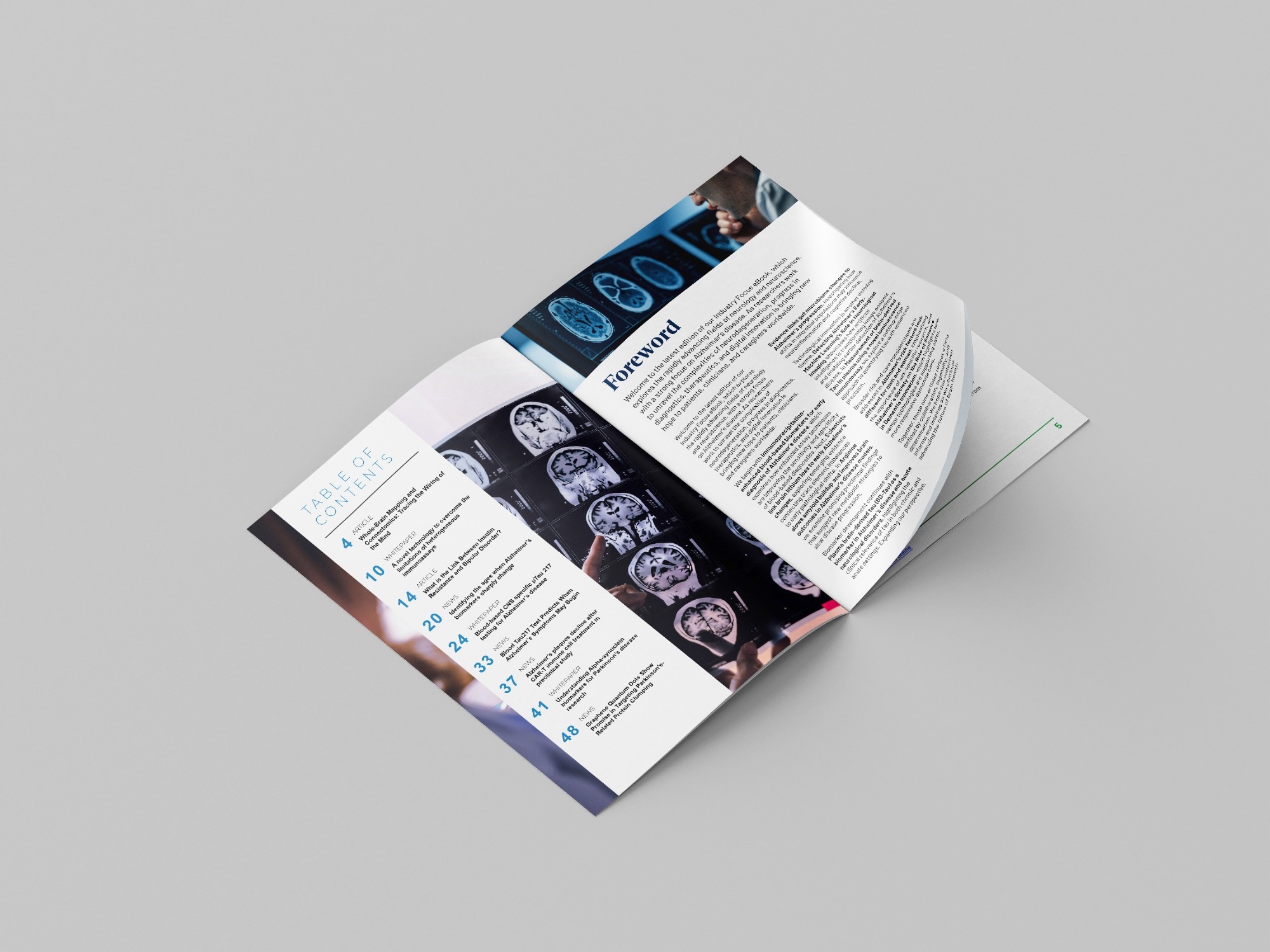 Industry Focus eBook - Neurology/Neuroscience - 2nd edition