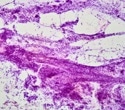 Linkam tensile stage chosen to control stress in growth of human collagen by the University of Liverpool