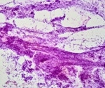 Linkam tensile stage chosen to control stress in growth of human collagen by the University of Liverpool
