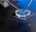 Sperm viability assessed in a number of UK fertility laboratories by using Linkam’s warm stages