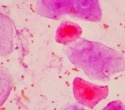Linkam Scientific Instruments report the use of CMS196 for the imaging of mammalian cells at the London Research Institute, Cancer Research UK