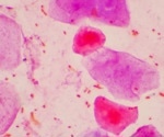 Linkam Scientific Instruments report the use of CMS196 for the imaging of mammalian cells at the London Research Institute, Cancer Research UK