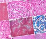 SARS-CoV-2 appears to persist in organs throughout the body for months