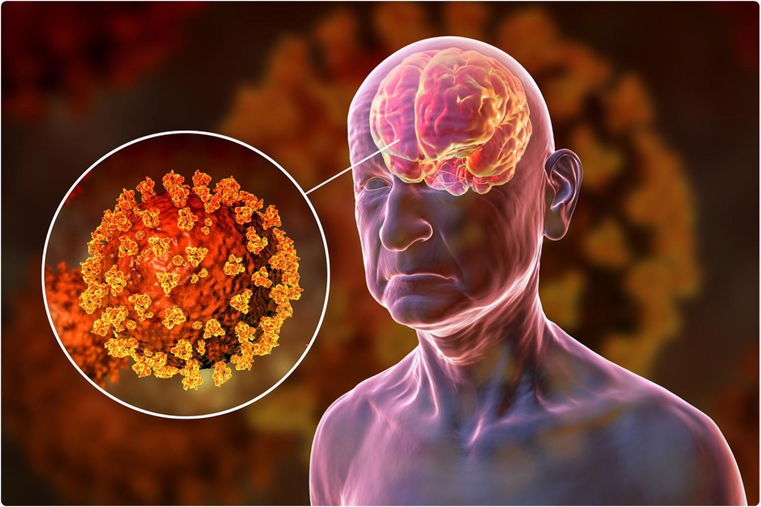 Neurological complications of the SARS-CoV-2 vaccine