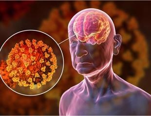 Neurological complications of the SARS-CoV-2 vaccine