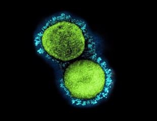 Assessing the association of COVID-19 and Immunoglobulin A vasculitis in children