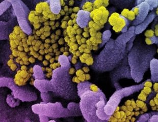 Antifungal agent Bifonazole as an antiviral against SARS-CoV-2