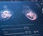 AI predicts if or when a patient could die of cardiac arrest
