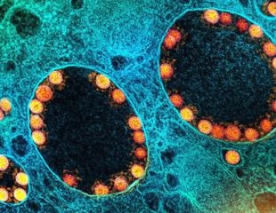 SARS-CoV-2 recombinant isolated from chronic COVID-19 patient