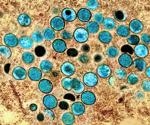 Lineages of monkeypox virus in the United States