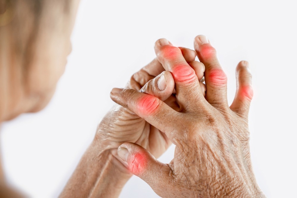 reumatoid artritisz