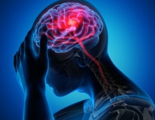 Designing a new treatment to treat migraine effectively