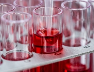The importance of accurate pipetting in biomedical laboratory work
