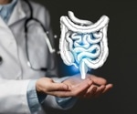 What do gut microbiota have to do with Alzheimer's and dementia?
