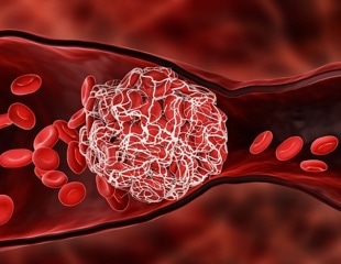 CardioGen upgrade facilitates more accurate diagnosis of monogenic cardiovascular diseases