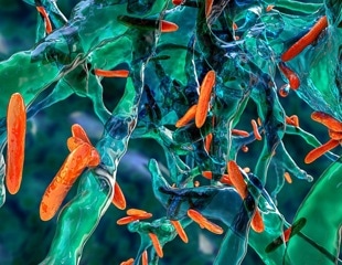 Study measures the annual prevalence of nontuberculous mycobacterial lung disease in Ontario, Canada