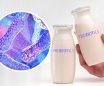Do probiotics supplements really make a difference during antibiotic treatment? Probably not, says research