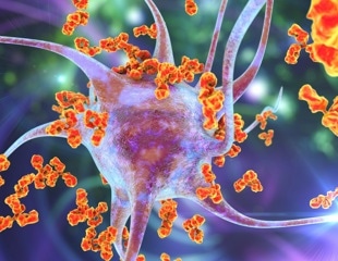 Small molecule inhibitor of the NLRP3 inflammasome for treating autoinflammatory diseases