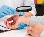 Psoriasis vs. atopic dermatitis: New study reveals surprising inflammatory differences in age-specific groups