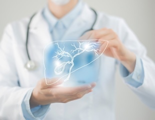 Robust detection of gallbladder cancer using deep-learning-assisted US imaging