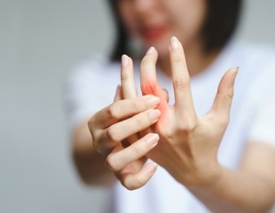 Research redefines rheumatoid arthritis: Over 314,000 cells analyzed for precise treatment strategies
