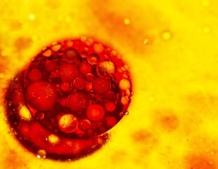 Key protein EPAC1 found to regulate brown fat growth, offering obesity treatment potential