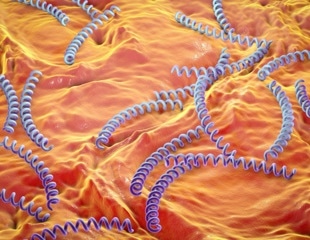 Syphilis: A silent epidemic reawakens