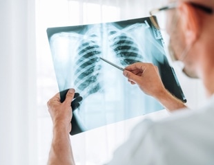 GPT-4 matches radiologist accuracy in spotting errors, cuts time and costs dramatically