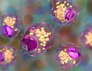 Genetic discovery reveals key to inflammatory diseases