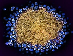 Novel antiviral protein SAMD9L blocks HIV-1 and other lentiviruses