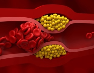 How lipoproteins shape your metabolic health