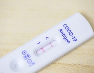 Link between COVID-19 and long-term risk of autoimmune and autoinflammatory connective tissue disorders