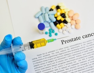 Prostate cancer vaccines: Progress, challenges, and future directions