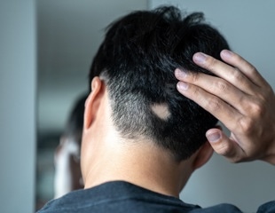Could serotonin supplements become the next hair loss treatment?