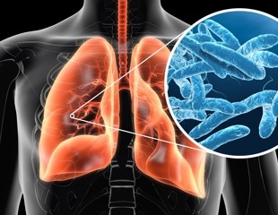 New Swiss study probes lingering fatigue after Legionnaires' disease