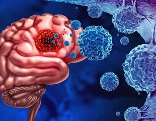 Polyphenols and exercise show promise in fighting gliomas