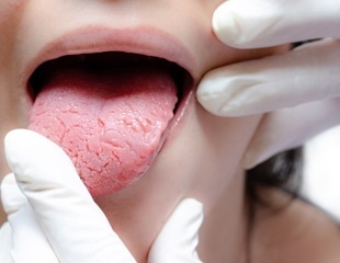 Can oral bacteria make heart disease worse?