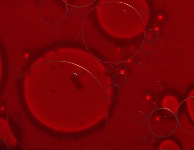 Small shifts in blood sodium may influence human brain excitability